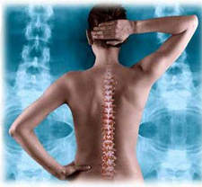 Osteochond2 остеоходроз лікування остеохонрозу, болі в спині, болить спина