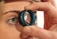 глаукома захворювання причини та лікування МКЛ3 Вінниця