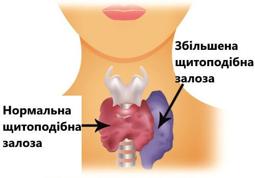 щитоподібна залоза
thyroid gland